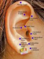 Auriculoterapia